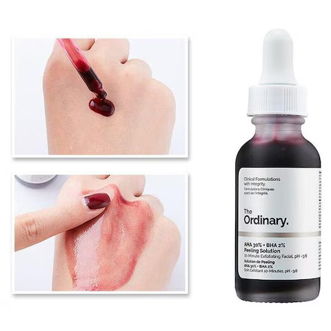 The Ordinary AHA 30%+BHA 2% Peeling Solution 30ml