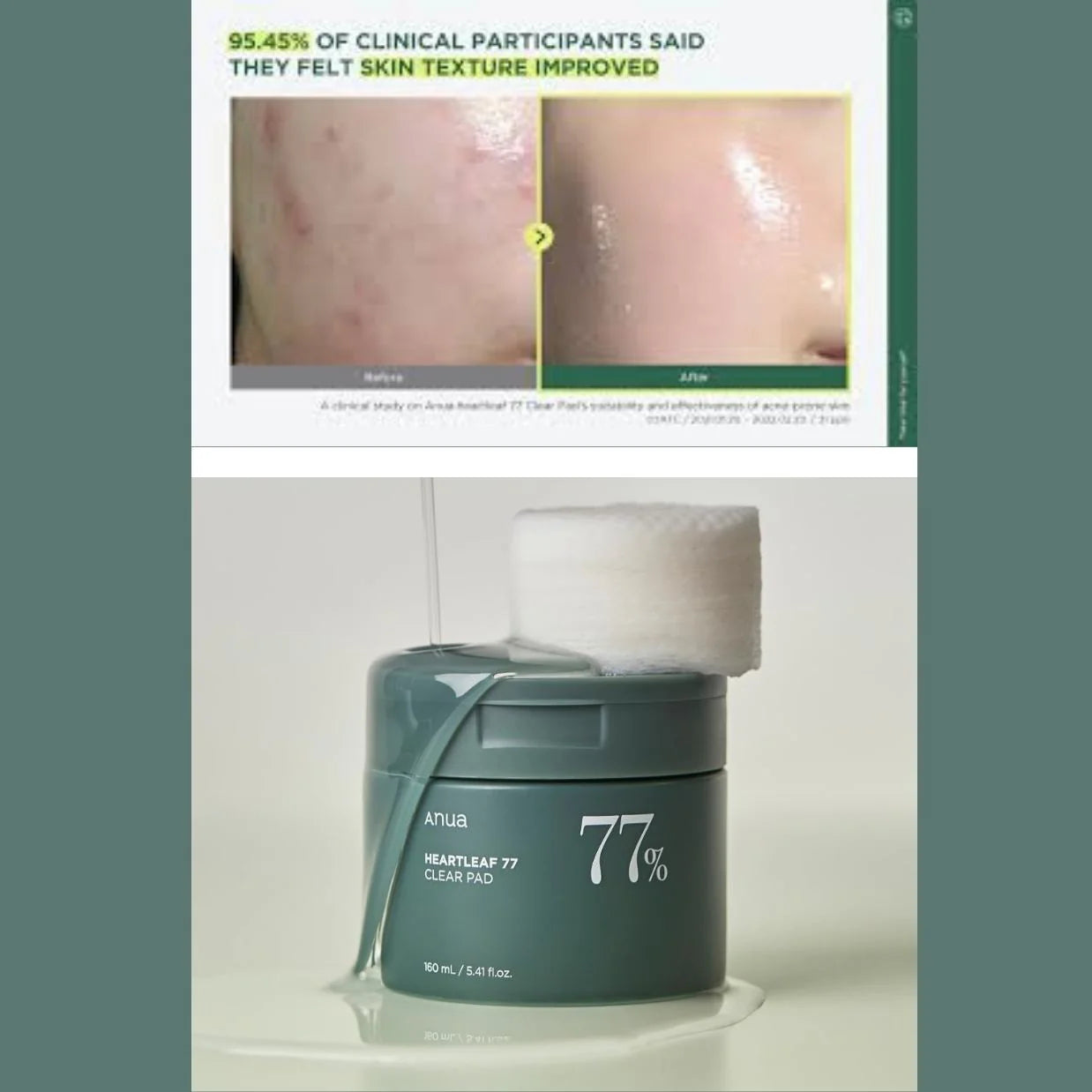 Anua Heartleaf 77 Clear Pad 160ml